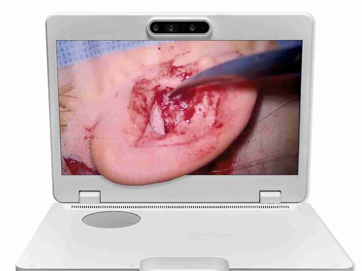 达擎之＂Heads-up 3D显微手术显示系统＂，，整合4K裸眼3D显示及眼球追踪系统，，，具备快速追踪人眼移动位置功能，，，，减轻医师长时间维持固定姿势的负担，，让医师能有更宽广清晰的3D立体视野及更舒适的姿势来执行手术。。